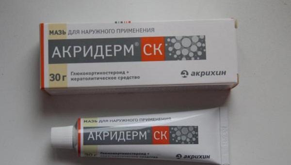 Чим мазати укуси комарів: 15 ефективних мазей