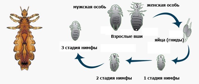 Як зрозуміти, що у тебе воші на голові?