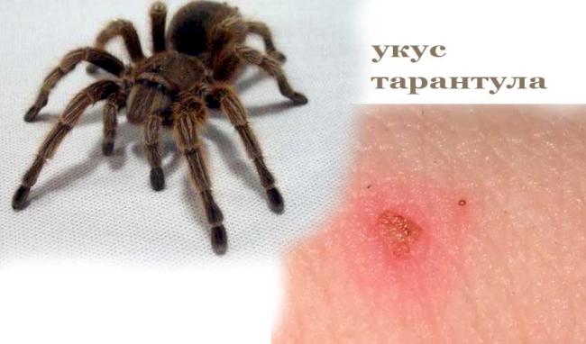 Як кусаються павуки: перша допомога в домашніх умовах
