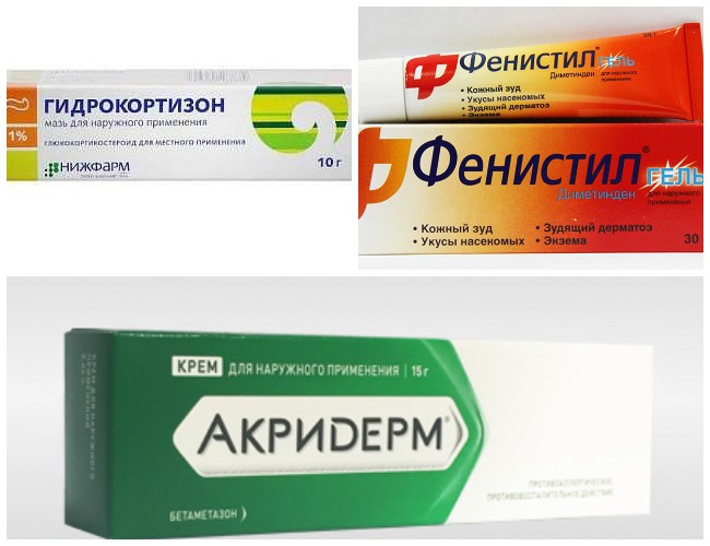 Ефективні способи зняття сверблячки від комариних укусів