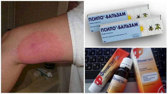 Лікуємо бджолиний укус у дитини