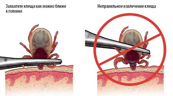 Як слід правильно витягувати кліща у собаки?
