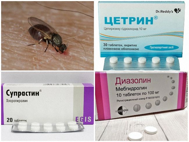 Чим лікувати укус мошки на нозі: як зняти набряк та почервоніння